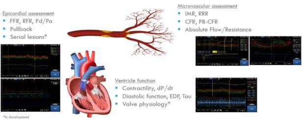 CoroFlow – Coroventis